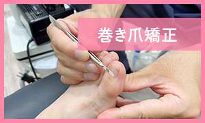 巻き爪矯正